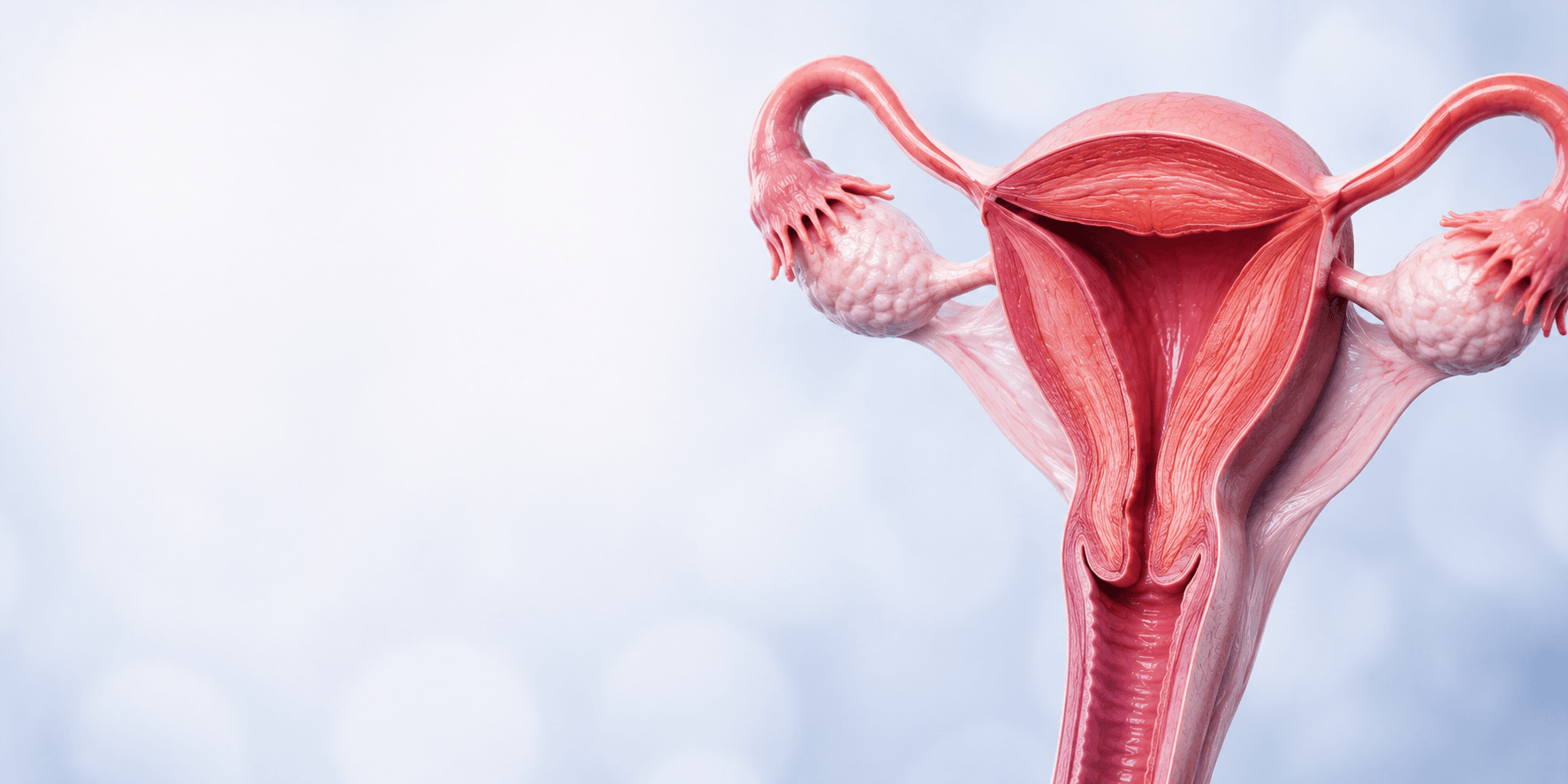 Hysterectomy