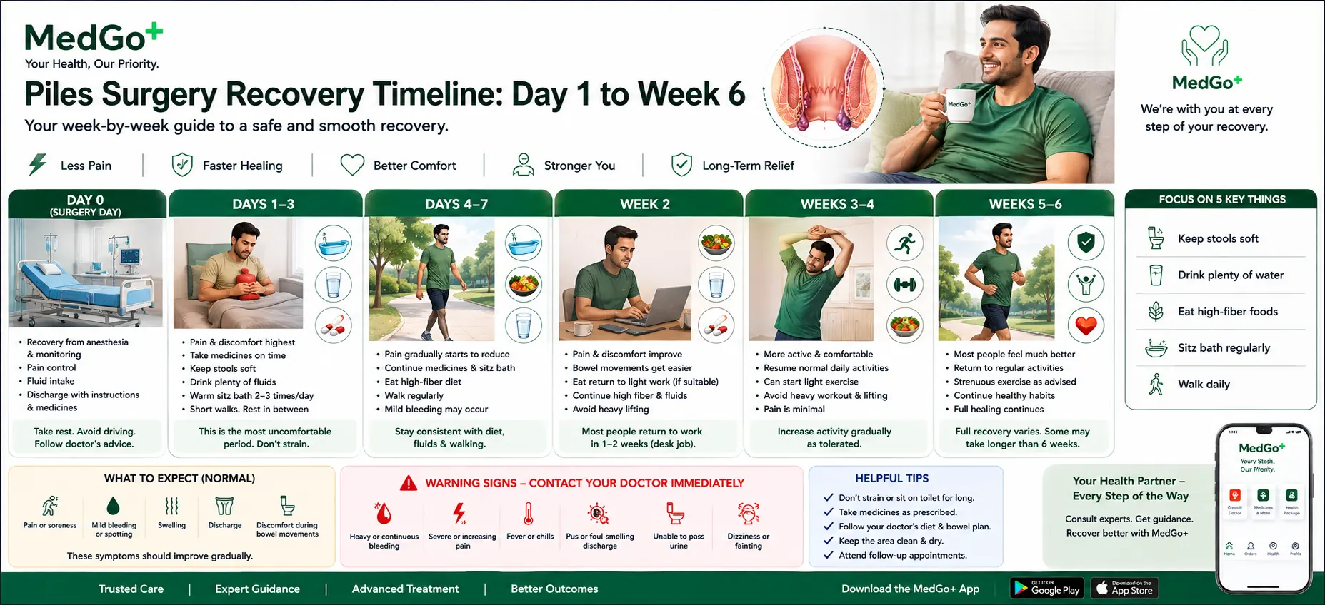 Piles Surgery Recovery Timeline: Day 1 to Week 6
