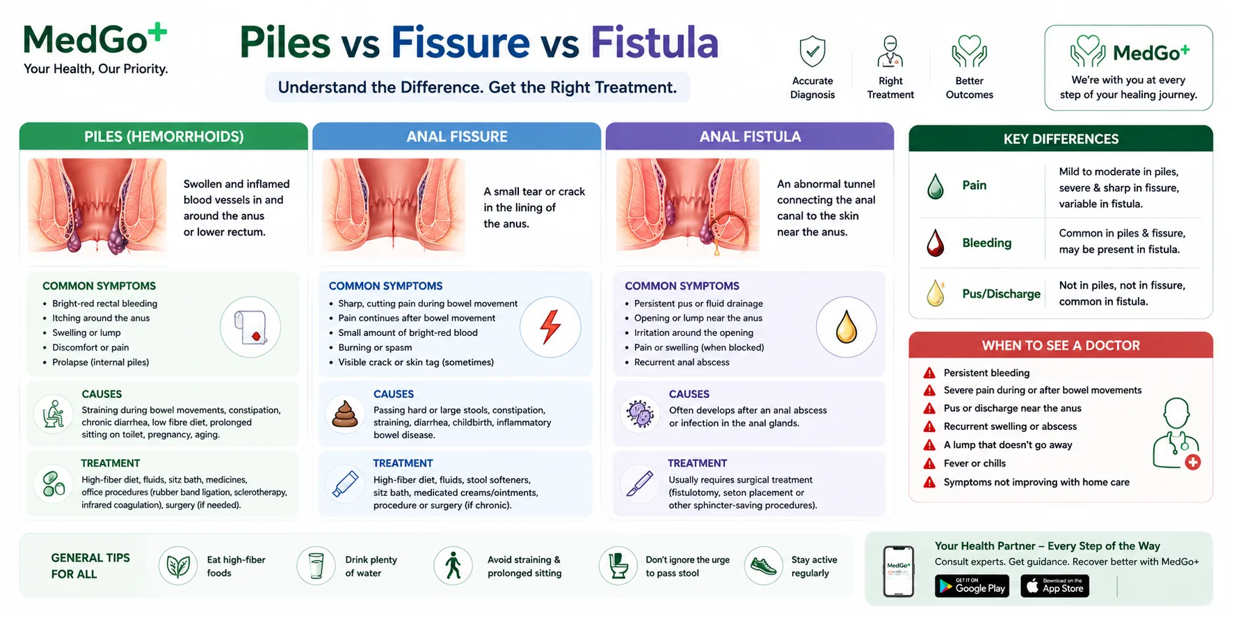 Piles vs Fissure vs Fistula: Symptoms, Differences, Causes & Treatment
