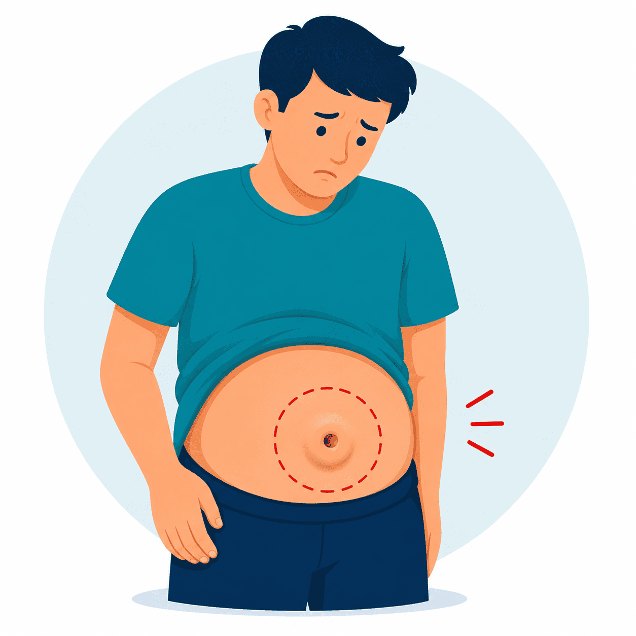 Bulge or swelling near the belly button