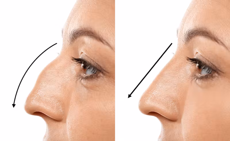 Dermatology (Surgical Procedures)