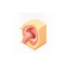 Sebaceous cyst