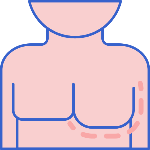 Gynecomastia Surgery