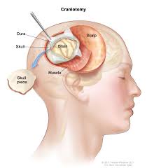 Kidney (Urology / Genitourinary Surgery)