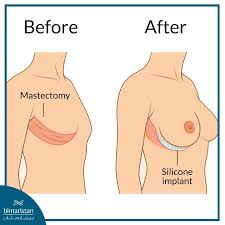 Gynaecology / Obstetrics