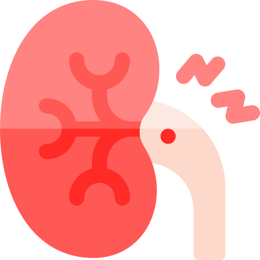 Kidney Stone