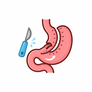 Bariatric surgery by MedGoPlus
